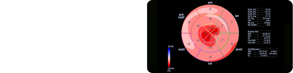 apical sparing